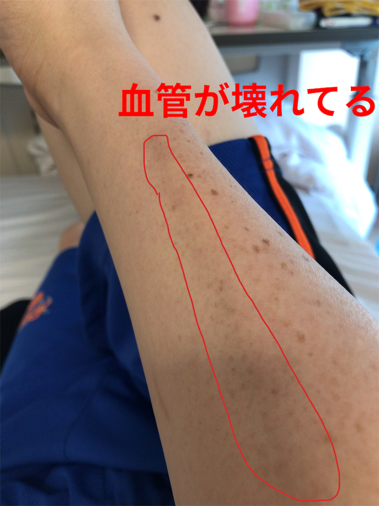 f:id:mutsukichikun:20190615124240p:image