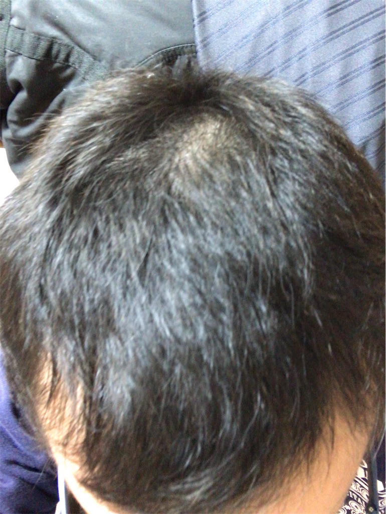 f:id:mutsukichikun:20191029173015j:image