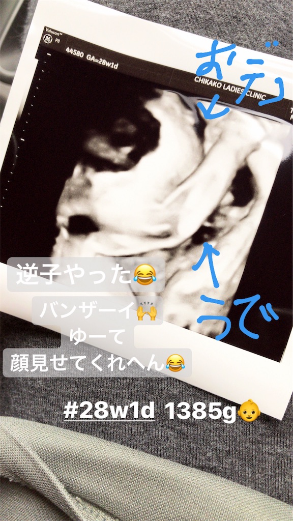 f:id:mutsumiabe501461:20190710152115j:image