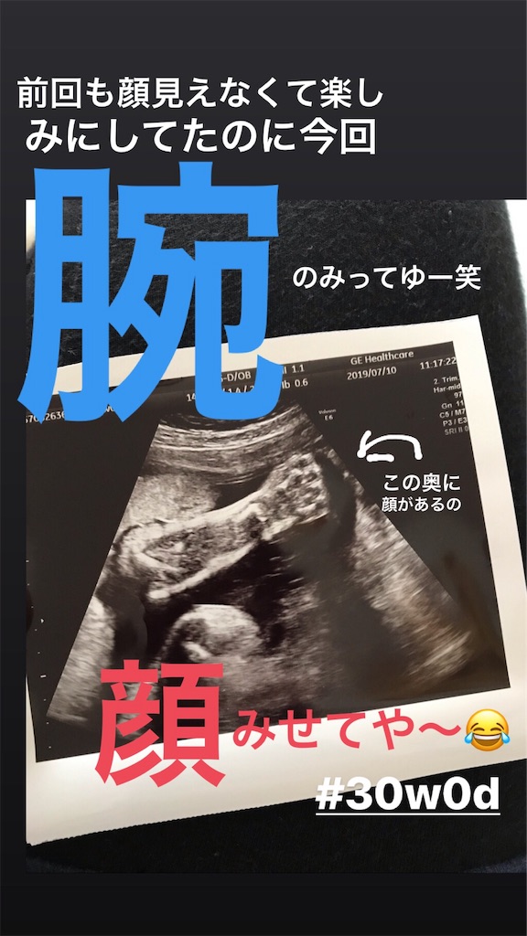 f:id:mutsumiabe501461:20190710152117j:image