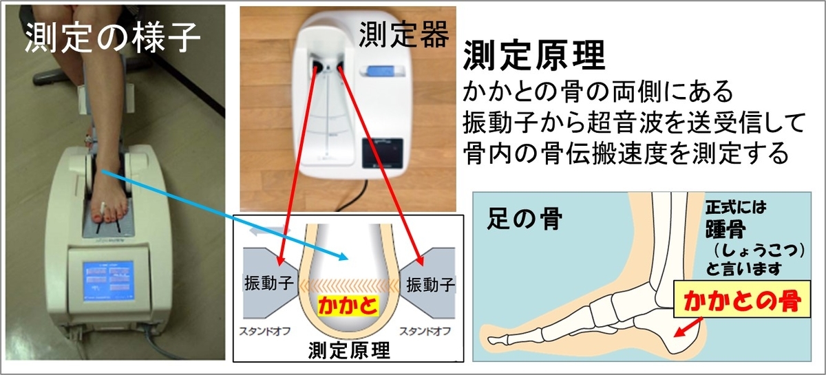 2-6-骨密度の測定方法