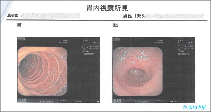 2-7-胃内視鏡の写真
