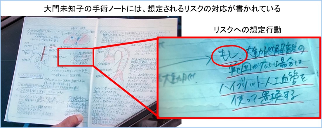大門未知子の手術ノートには想定されるリスクの対応が書かれている