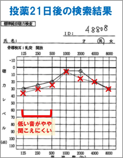 ３－１－投薬21日後の聴力検査の結果