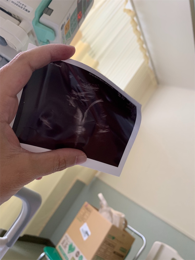 f:id:myktmk525ysk:20190911213101j:image