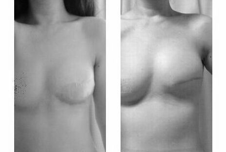 f:id:mylifeafterbc:20180912160212j:plain f:id:mylifeafterbc:20180912160212j:plain