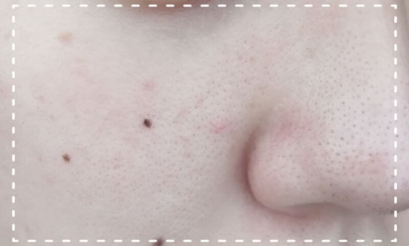 f:id:myu_skin:20200828144412j:plain