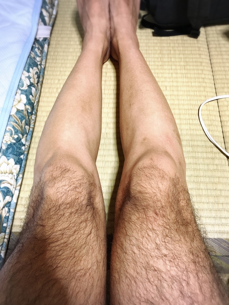 f:id:n6c54fh1:20180730010440j:plain