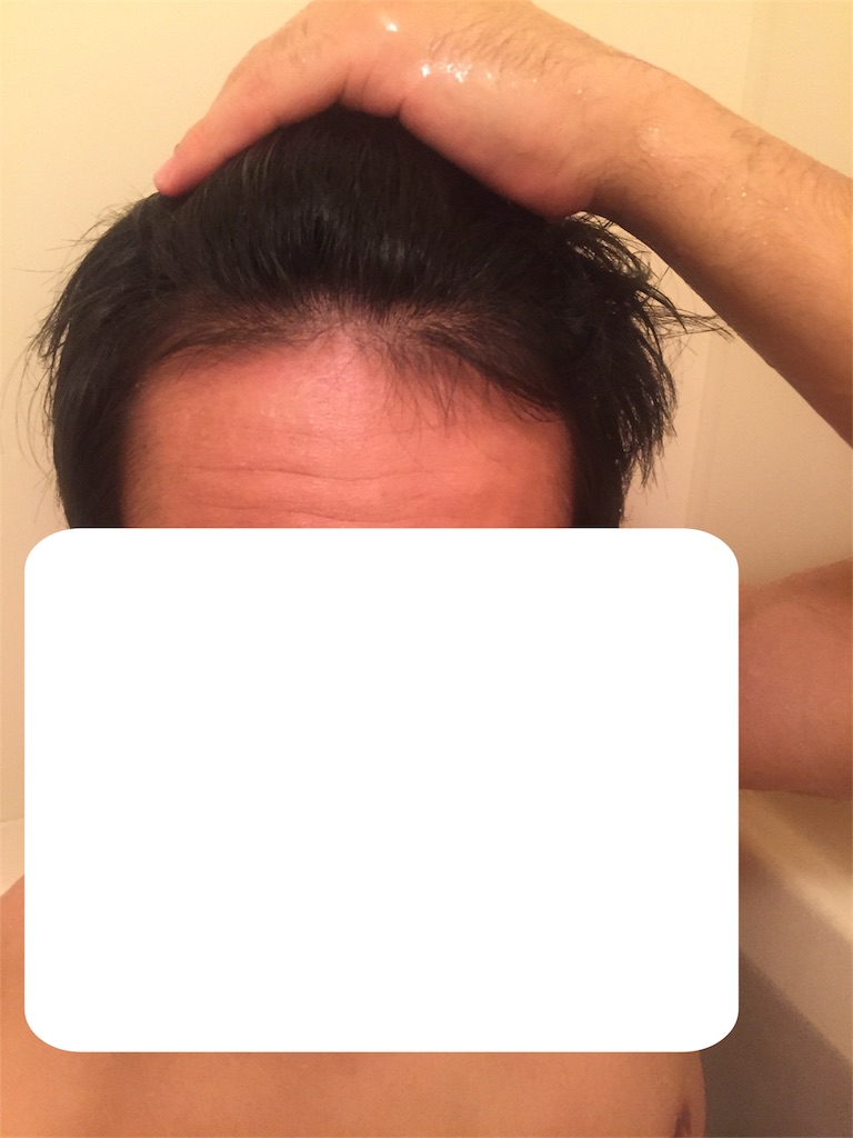 f:id:na-nnimonaizou:20171023232825j:image f:id:na-nnimonaizou:20171023232825j:image