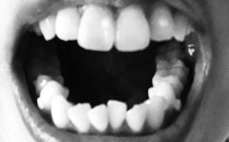 f:id:naitooth:20191009221252j:plain f:id:naitooth:20191009221252j:plain