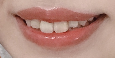f:id:naitooth:20191009221322j:plain f:id:naitooth:20191009221322j:plain