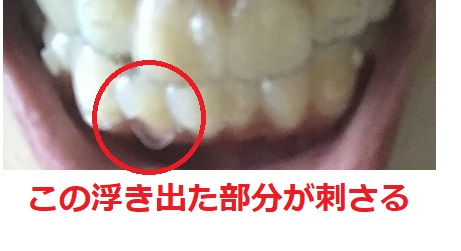 f:id:naitooth:20191015152642j:plain f:id:naitooth:20191015152642j:plain