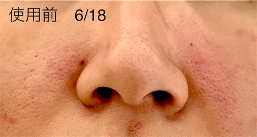 f:id:naki0513:20200813125831j:plain