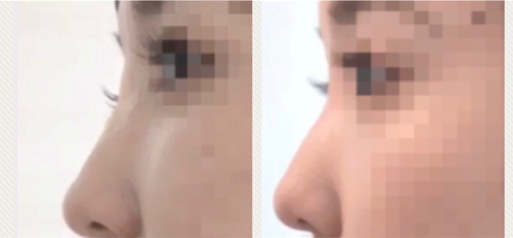 f:id:namacombu88:20190306215101j:image:w300 f:id:namacombu88:20190306215101j:image:w300
