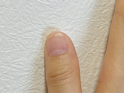 f:id:nanacoro8oki:20220406141838j:plain