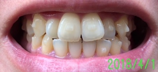 f:id:nanana38go:20180331212103j:plain