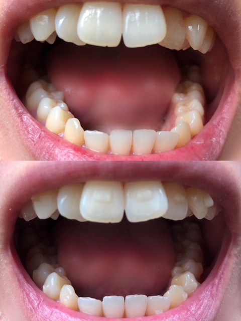 f:id:nanana38go:20180331213750j:plain