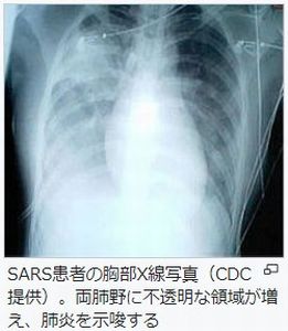 f:id:naniuji:20200413203804j:plain