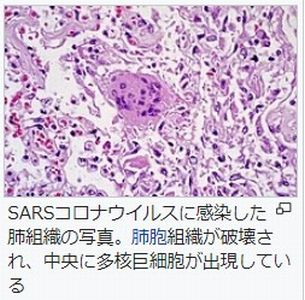 f:id:naniuji:20200413203832j:plain