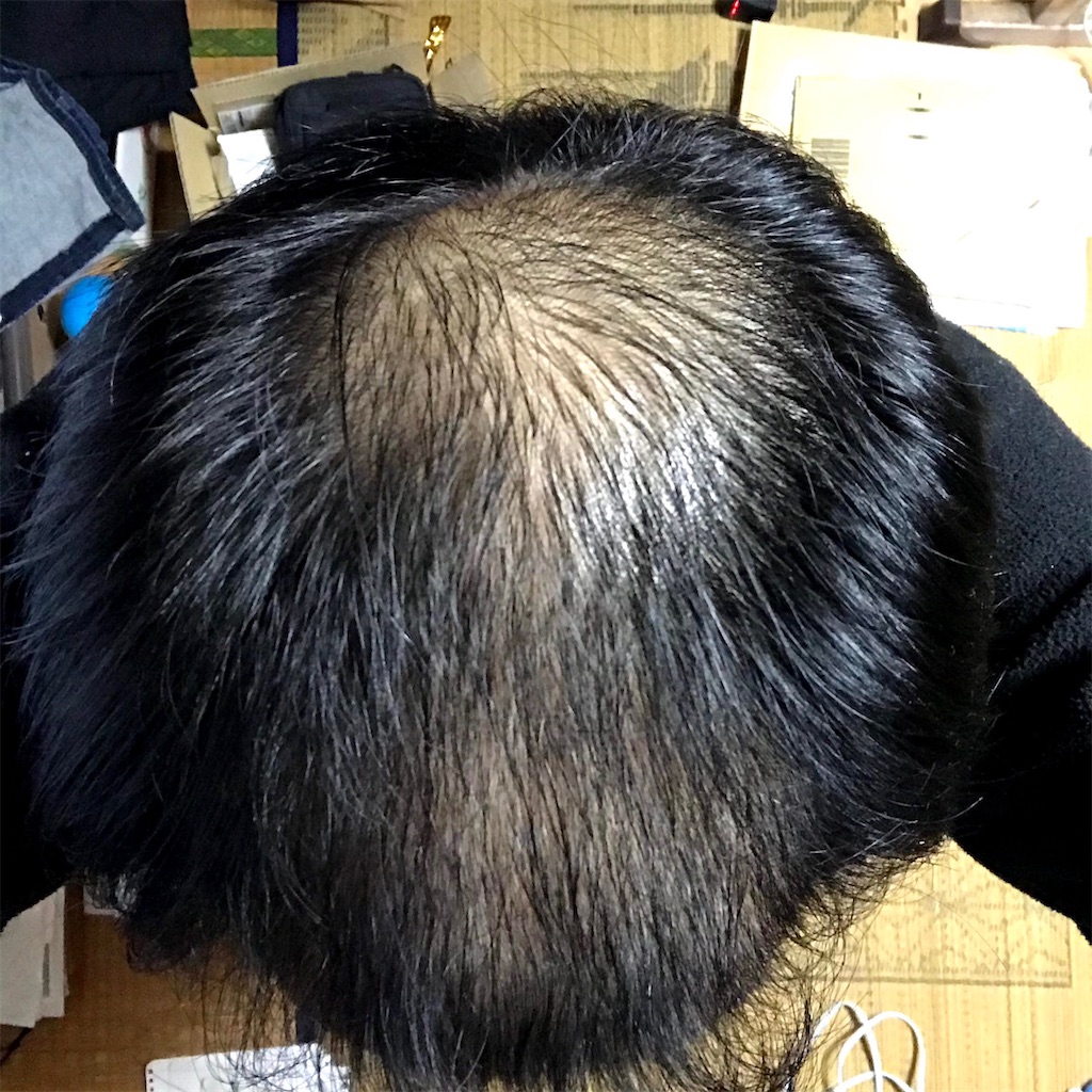 f:id:nanndome:20201104231342j:image f:id:nanndome:20201104231342j:image