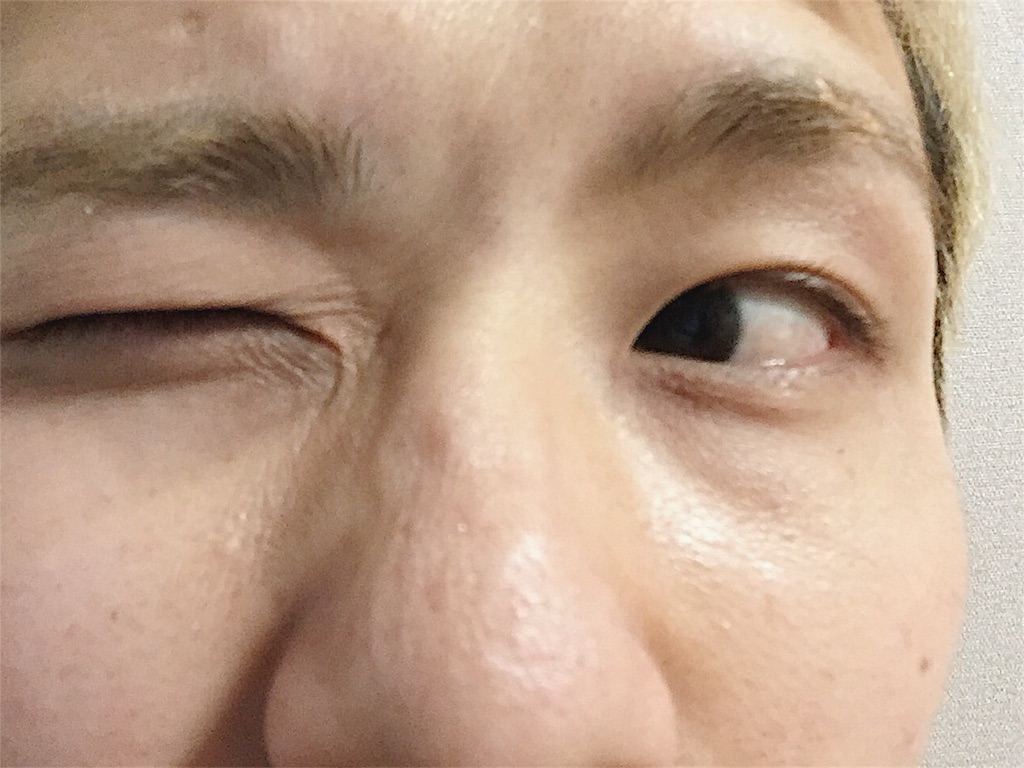 f:id:naoki1221:20180308221632j:image f:id:naoki1221:20180308221632j:image