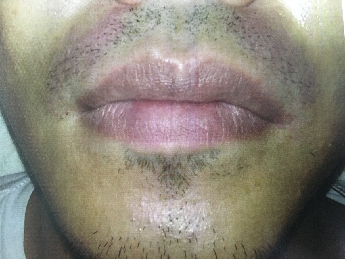 f:id:nappy3:20200503170847j:plain