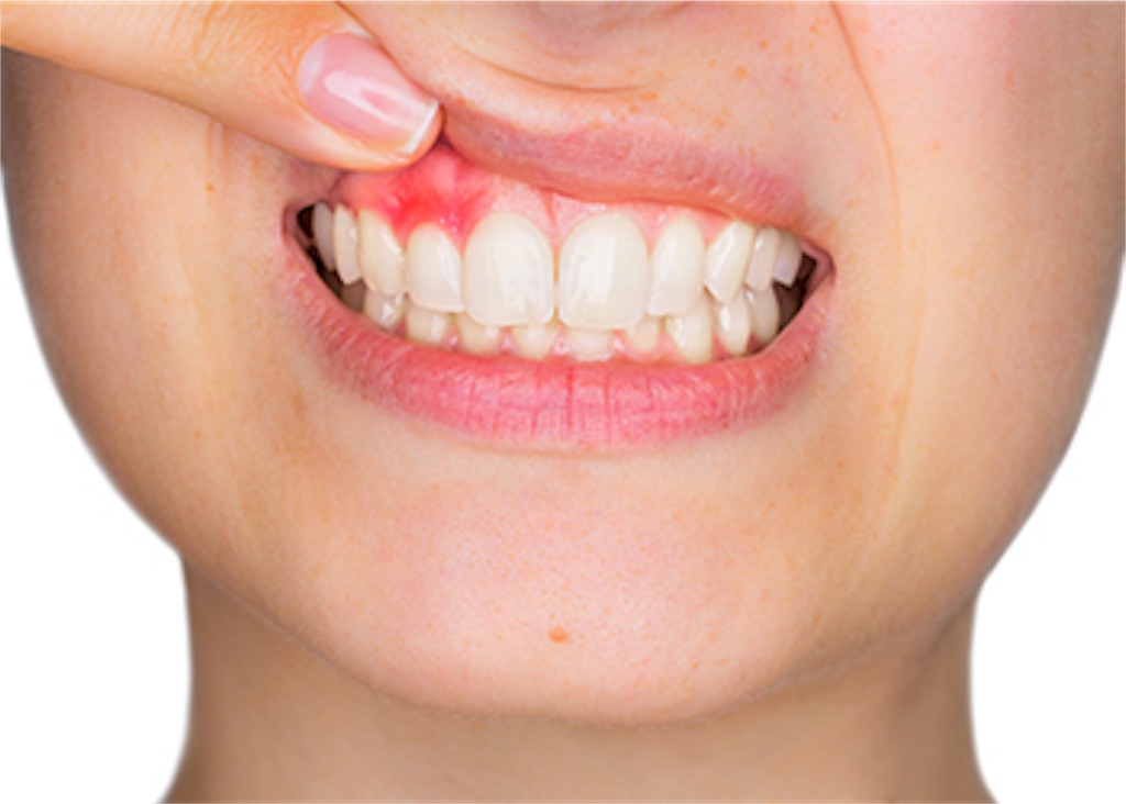 f:id:naratsune:20190624213427j:image