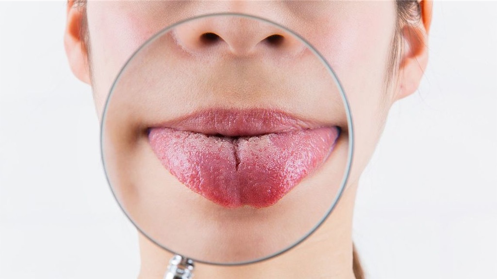 f:id:naratsune:20190627214542j:image