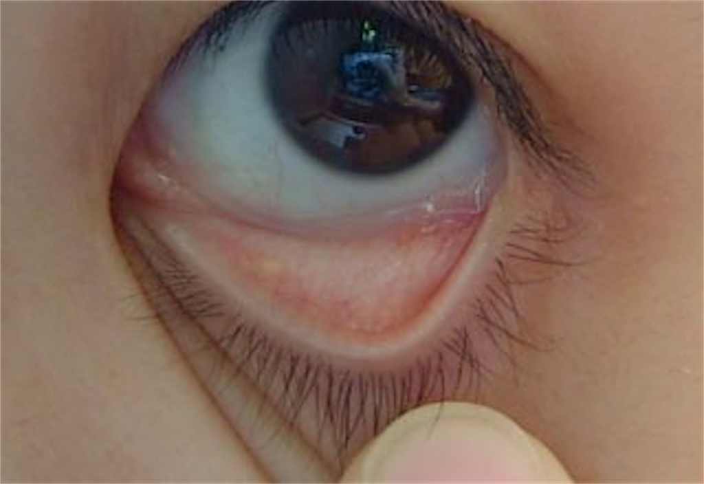 f:id:naratsune:20190627215920p:image