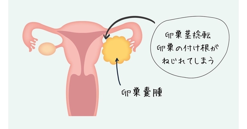 f:id:nasumiblog:20210104154126j:plain