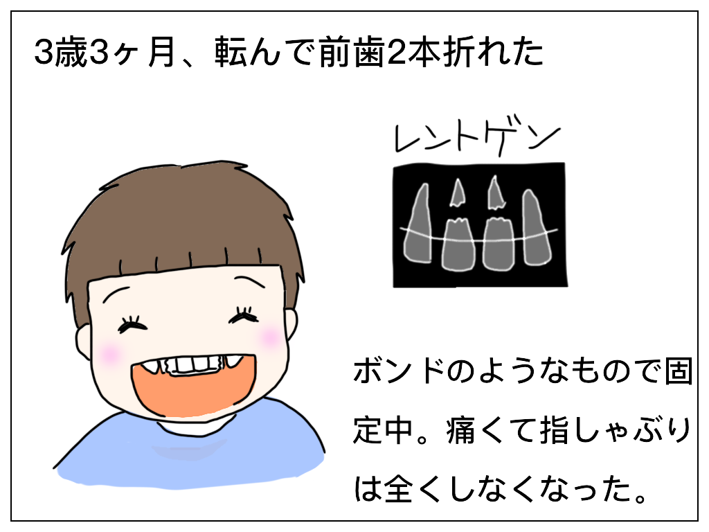 f:id:natsuf:20181112024825p:plain