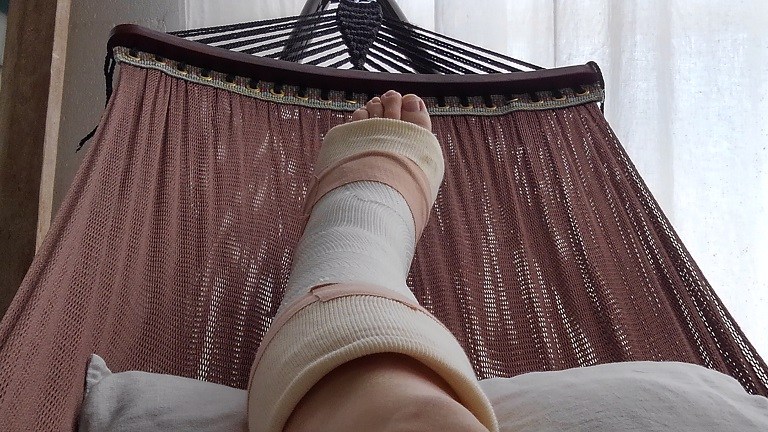 アキレス腱断裂 その時パチンと音が鳴った Feekazi