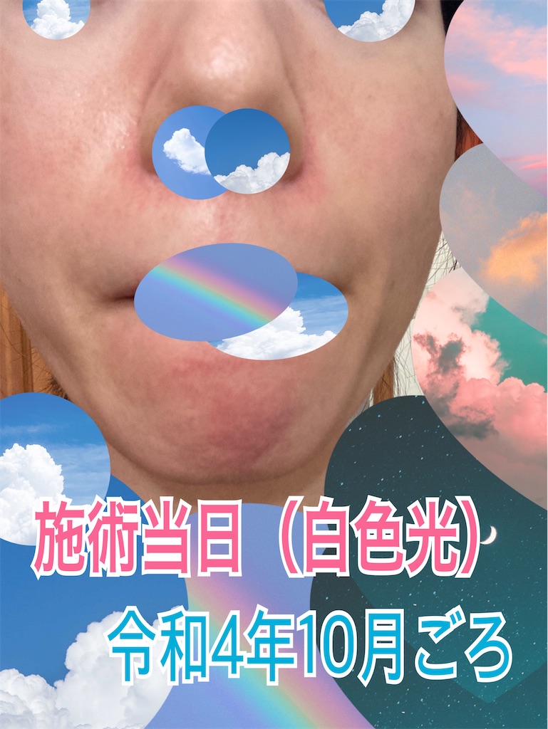 f:id:neatralll:20230325002046j:image