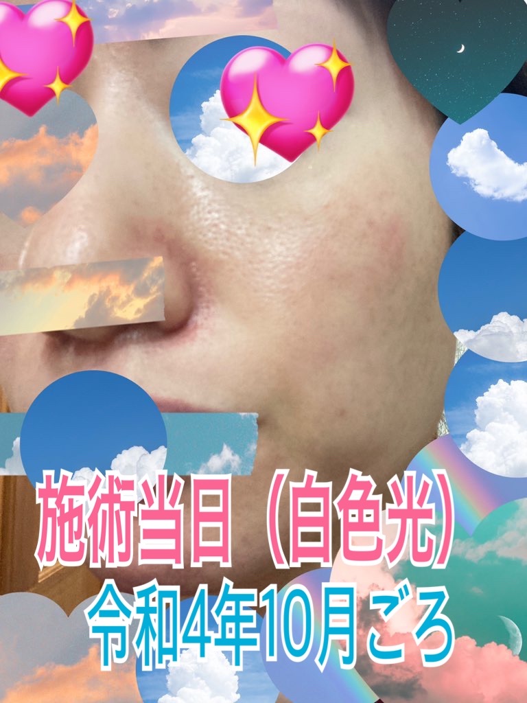 f:id:neatralll:20230325002115j:image