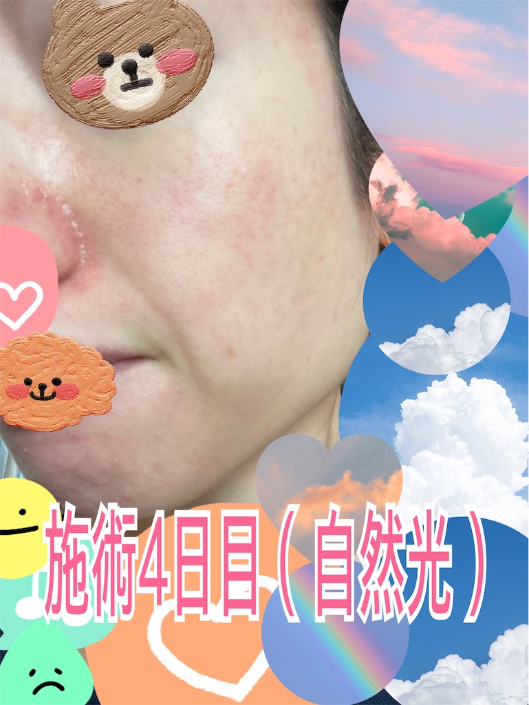f:id:neatralll:20230325002159j:image