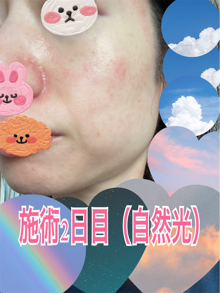 f:id:neatralll:20230325002202j:image