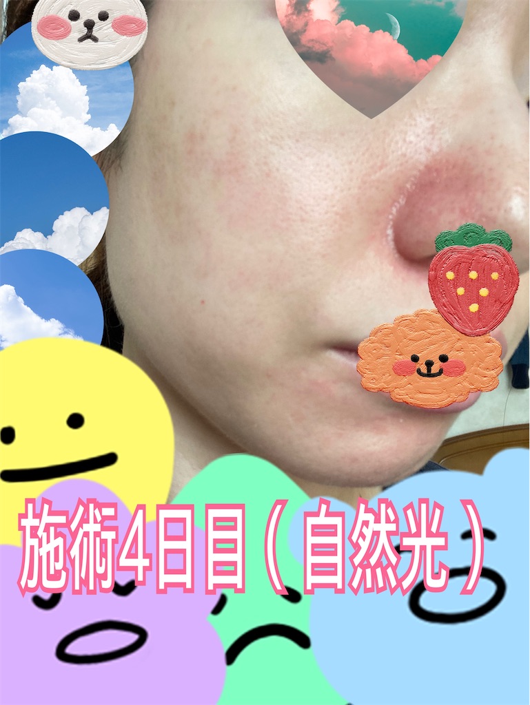 f:id:neatralll:20230325002251j:image