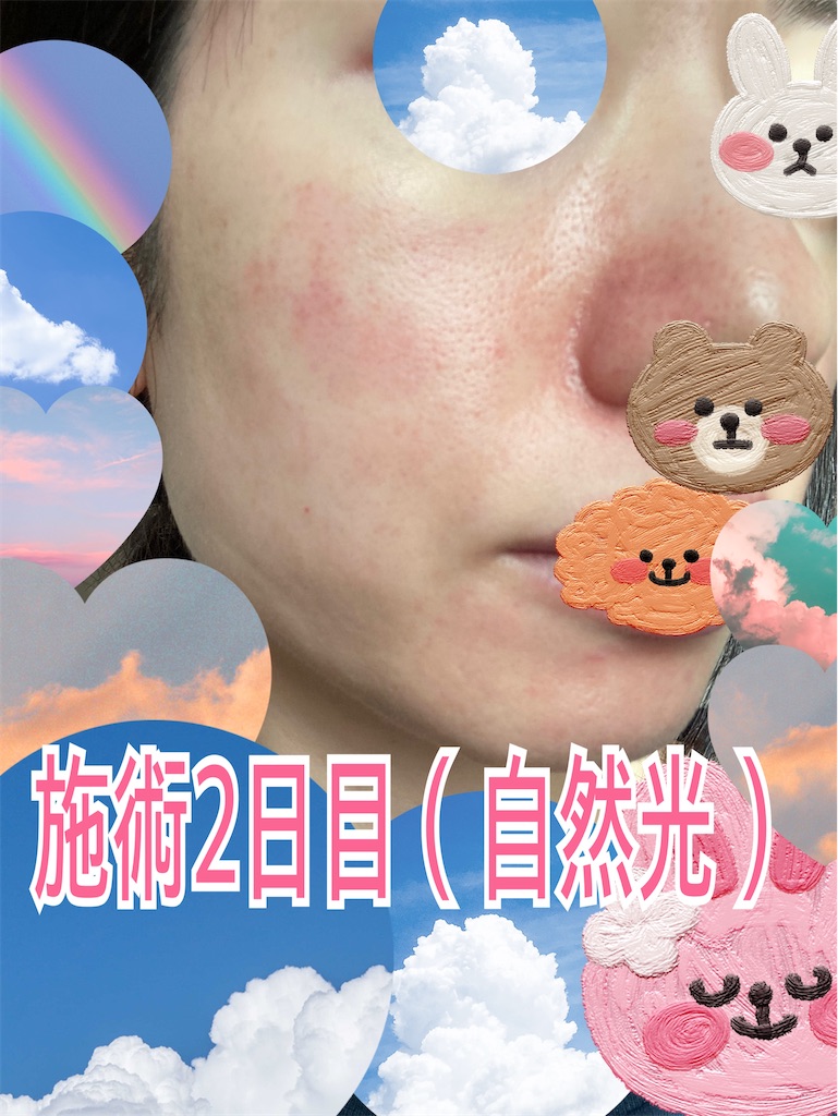 f:id:neatralll:20230325002254j:image