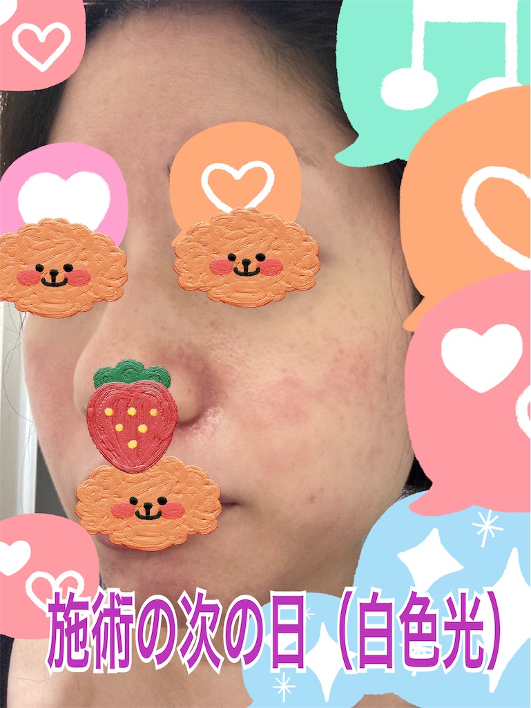 f:id:neatralll:20230413142221j:image