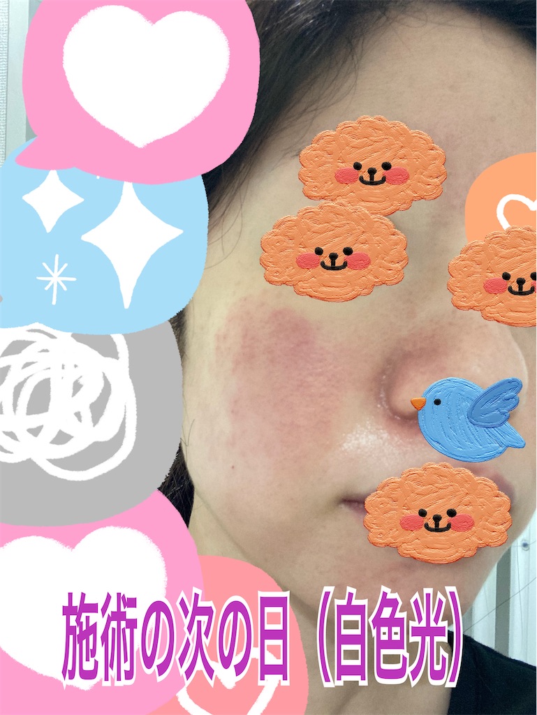 f:id:neatralll:20230413142224j:image
