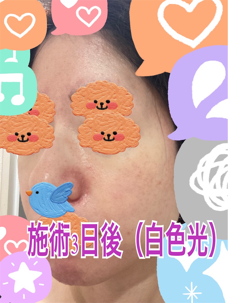 f:id:neatralll:20230413142511j:image