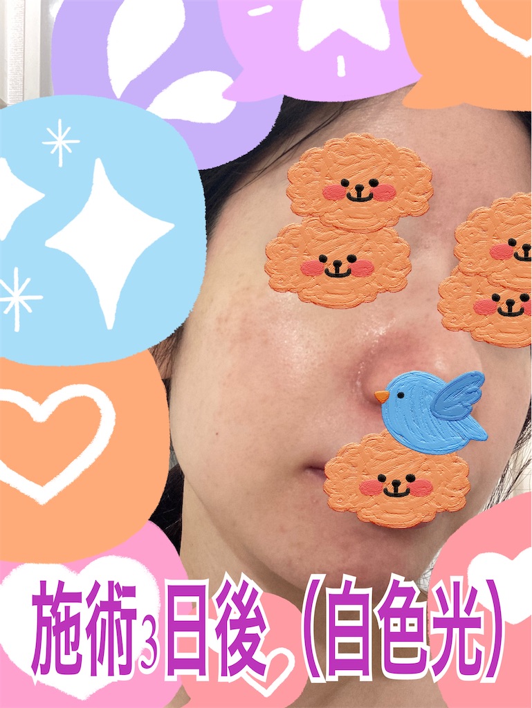 f:id:neatralll:20230413142514j:image