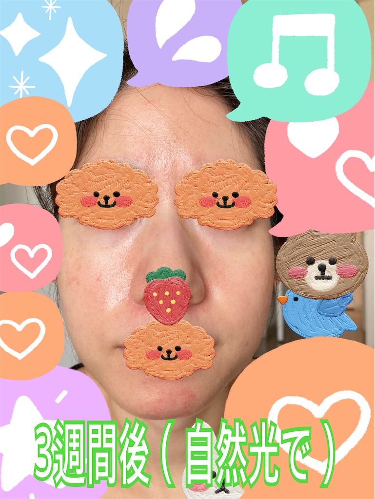 f:id:neatralll:20230413142624j:image