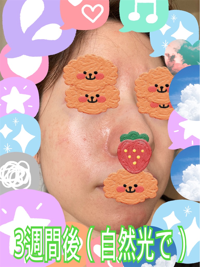 f:id:neatralll:20230413142642j:image