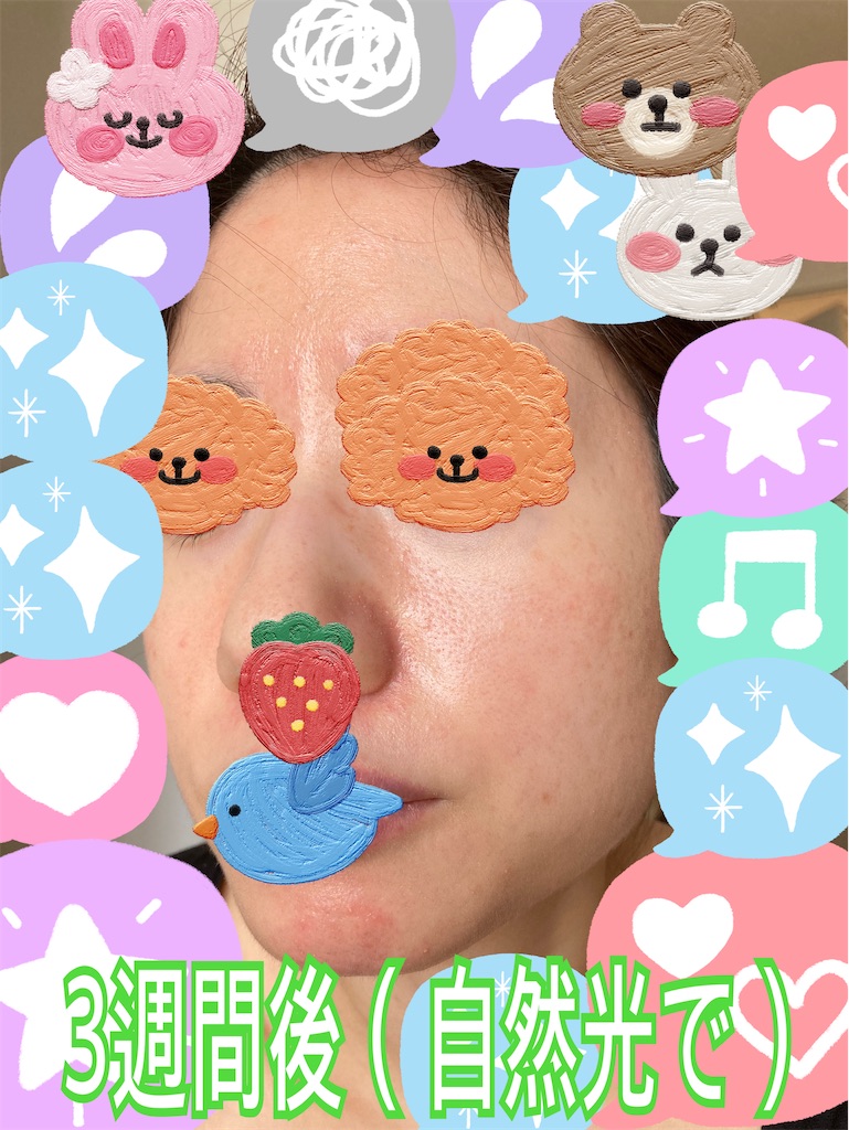 f:id:neatralll:20230413142645j:image