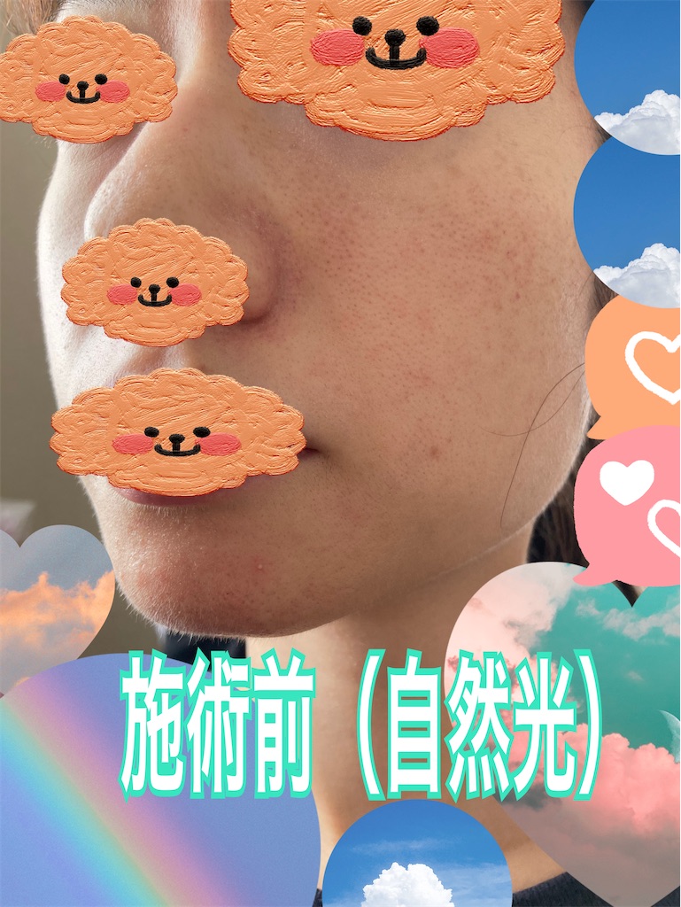 f:id:neatralll:20230531145426j:image