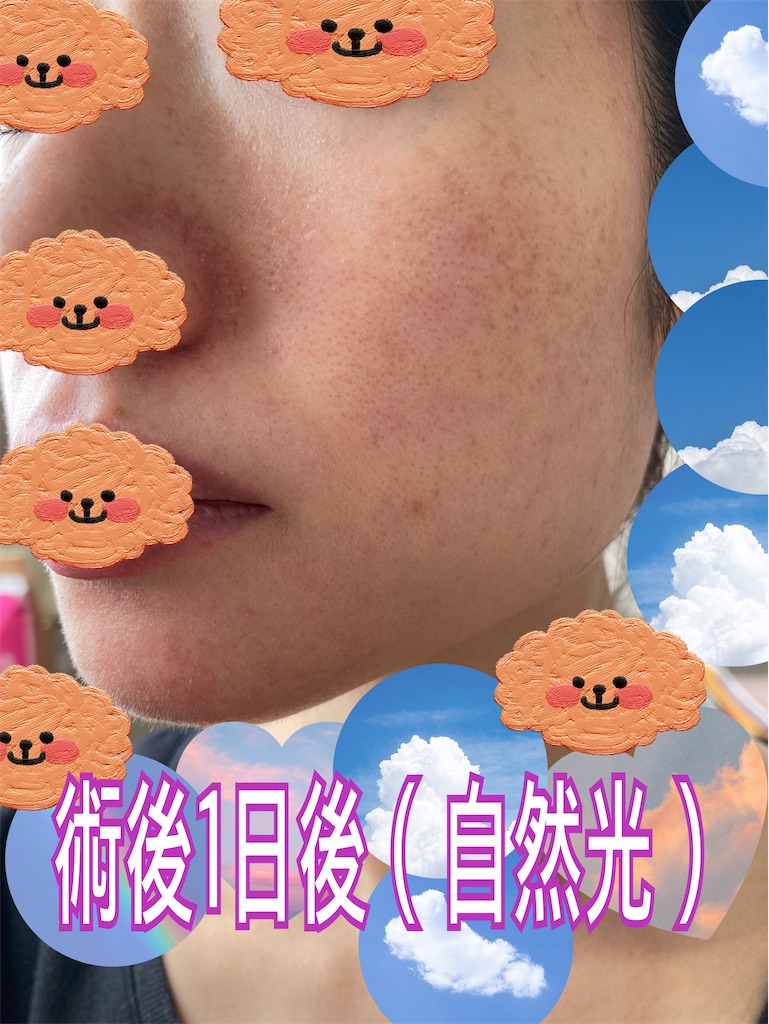 f:id:neatralll:20230531145429j:image