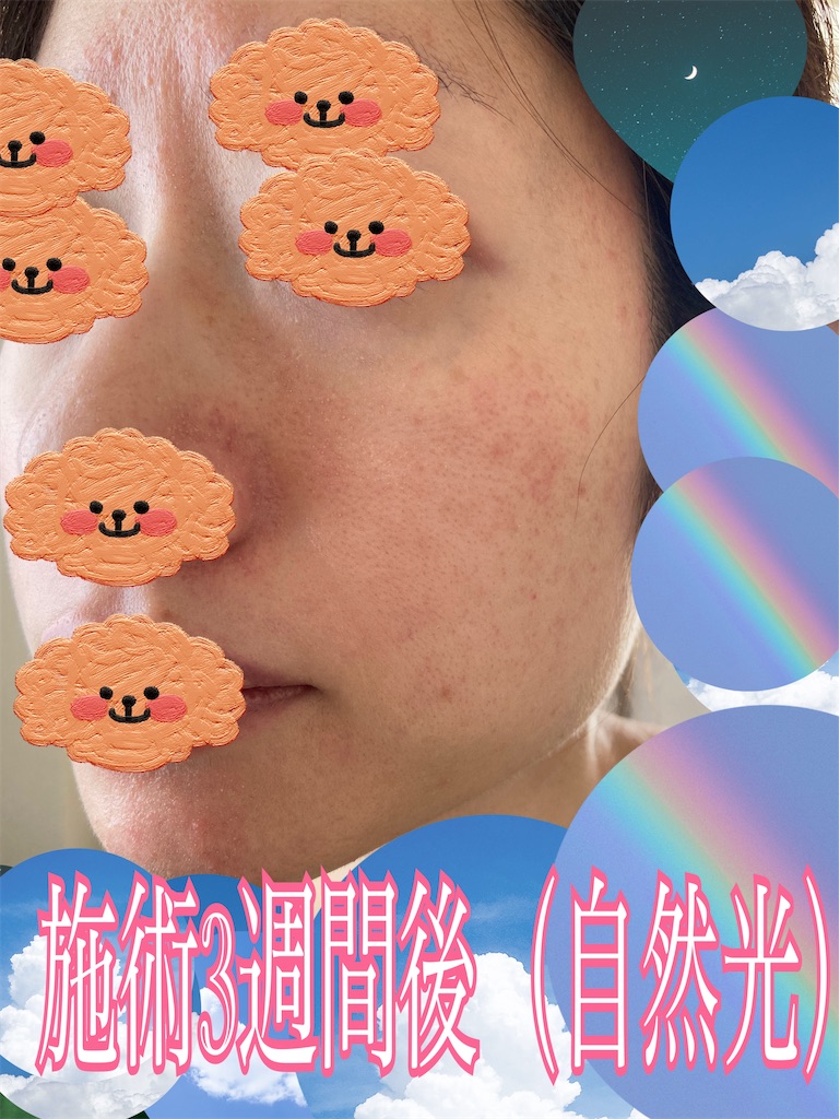 f:id:neatralll:20230531145506j:image