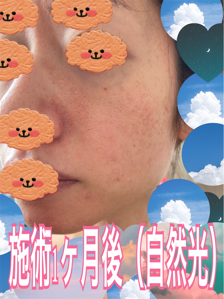 f:id:neatralll:20230531145509j:image