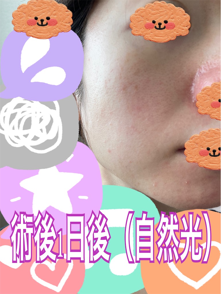 f:id:neatralll:20230531145536j:image